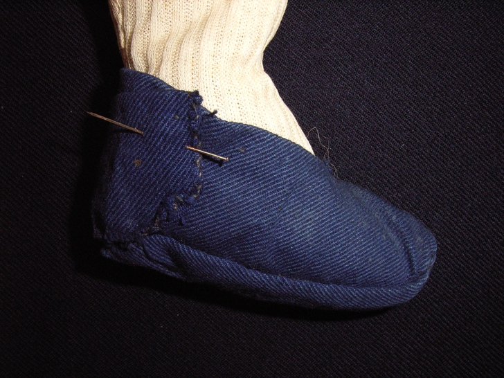 Piede destro prima del restauro